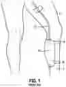 Fig. 02 - Leg strap assembly for a urine bag