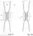 Fig. 09 - Method for controlling flow of eggs in a uterine tube