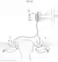 Fig. 17 - Method for controlling flow of eggs in a uterine tube