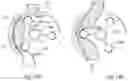 Fig. 33 - Method for controlling flow of eggs in a uterine tube