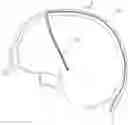 Fig. 01 - IMPLANTABLE PROBE FOR LOCALIZED COOLING