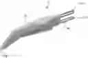 Fig. 01 - OPHTHALMIC MARKING DEVICE AND METHOD OF USING SAME