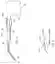 Fig. 05 - OPHTHALMIC MARKING DEVICE AND METHOD OF USING SAME