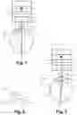 Fig. 02 - DEVICE FOR TREATING EYE TISSUE BY MEANS OF A PULSED LASER BEAM