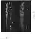 Fig. 09 - Absorbent negative pressure wound therapy dressing