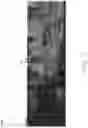 Fig. 11 - Absorbent negative pressure wound therapy dressing
