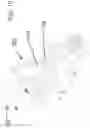 Fig. 11 - Nonmetallic wheelchair