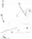 Fig. 12 - Nonmetallic wheelchair