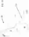 Fig. 13 - Nonmetallic wheelchair