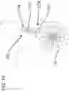 Fig. 17 - Nonmetallic wheelchair