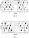 Fig. 05 - SAFE AND EFFICIENT VIBROTACTILE MULTI-CHANNEL STIMULATION FOR THE TREATMENT OF BRAIN DISORDERS