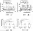 Fig. 09 - SAFE AND EFFICIENT VIBROTACTILE MULTI-CHANNEL STIMULATION FOR THE TREATMENT OF BRAIN DISORDERS