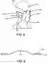 Fig. 04 - Intimate Wipes