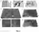 Fig. 05 - MINERALIZATION OF CELL-LADEN MATRICES