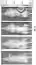 Fig. 14 - MINERALIZATION OF CELL-LADEN MATRICES
