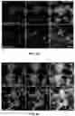 Fig. 17 - MINERALIZATION OF CELL-LADEN MATRICES