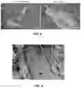 Fig. 20 - MINERALIZATION OF CELL-LADEN MATRICES