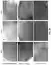 Fig. 32 - MINERALIZATION OF CELL-LADEN MATRICES