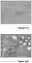 Fig. 07 - METHODS FOR REDUCTION OF PATHOLOGICAL FIBROSIS AND ASSOCIATED DISORDERS AND DISEASES