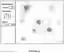 Fig. 06 - System and method for differentially locating and modifying audio sources