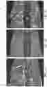 Fig. 02 - IMPLEMENT MOUNTED SENSORS SENSING SURFACE/FURROW CHARACTERISTICS AND CONTROL