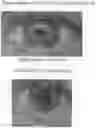 Fig. 01 - VASOCONSTRICTION COMPOSITIONS AND METHODS OF USE