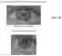 Fig. 06 - VASOCONSTRICTION COMPOSITIONS AND METHODS OF USE
