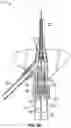 Fig. 07 - SYSTEMS AND METHODS TO IMPROVE INSTRUMENT GUIDANCE WITHIN AN INTRAVENOUS CATHETER ASSEMBLY