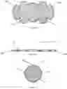 Fig. 08 - Bowling ball enclosure