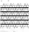 Fig. 02 - Liquid crystal display panel and display device