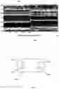 Fig. 07 - Micro Motion Detection for Determining at least one Vital Sign of a Subject