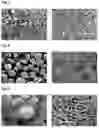 Fig. 04 - FREEZE-DRIED ARIPIPRAZOLE FORMULATION