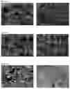 Fig. 05 - FREEZE-DRIED ARIPIPRAZOLE FORMULATION