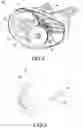 Fig. 03 - Cable-pull actuation system for a parking brake, parking brake and method for unlocking a parking brake thereof
