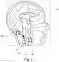 Fig. 02 - Determination of a further processing location in magnetic resonance imaging