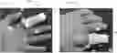 Fig. 01 - SURGICAL SLEEVE