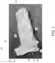 Fig. 02 - SURGICAL SLEEVE