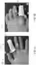 Fig. 03 - SURGICAL SLEEVE