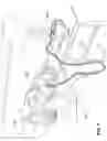 Fig. 02 - Respiratory pressure therapy system