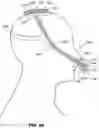 Fig. 09 - Respiratory pressure therapy system