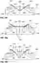 Fig. 45 - Respiratory pressure therapy system