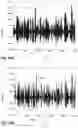 Fig. 75 - Selectively conditioning audio signals based on an audioprint of an object