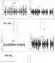 Fig. 76 - Selectively conditioning audio signals based on an audioprint of an object