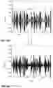 Fig. 77 - Selectively conditioning audio signals based on an audioprint of an object