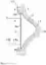 Fig. 02 - Vibration module for placement on an eardrum