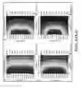 Fig. 45 - System and method for estimating tissue heating of a target ablation zone for electrical-energy based therapies