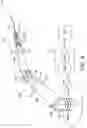 Fig. 04 - METHODS AND SYSTEMS FOR PROVIDING ASSISTANCE TO A USER OF A SURGICAL ROBOT SYSTEM