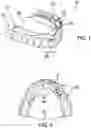 Fig. 02 - Orthodontic Appliance Covering Device