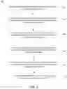 Fig. 02 - Open-loop insulin delivery basal parameters based on insulin delivery records