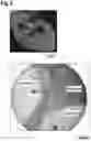 Fig. 15 - Method of treating a sample